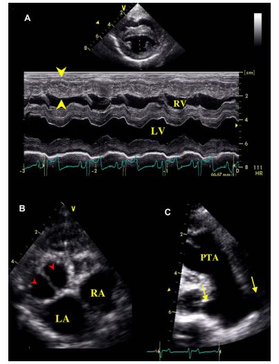 Figure 1 Two-dimensional and M-mode echocardiography