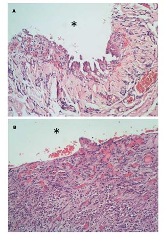 Histological images of epicardium (A) and endocardium (B)