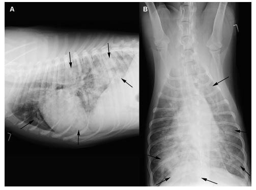 Right lateral (A) and ventrodorsal (B) thoracic radiographs of a dog infected with A