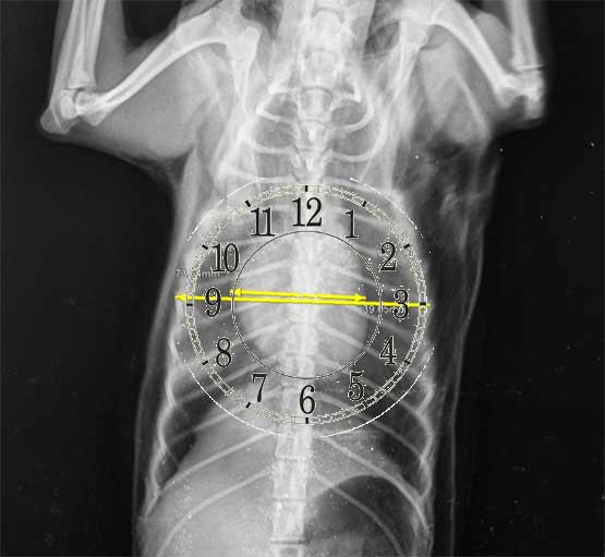 Пример наложения силуэта циферблата часов на рентгеновский снимок, выполненный в прямой проекции