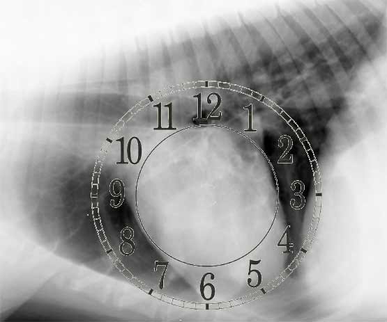 Пример наложения системы циферблата часов на  рентгенографический снимок, выполненный в боковой проекции лежа на правом боку