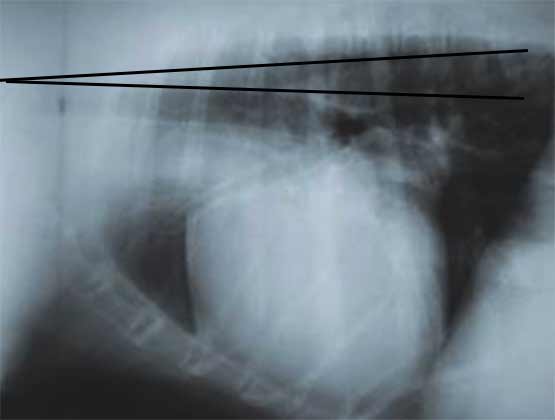 Вертебротрахеальный угол у собаки, больной дилатационной кардиомиопатией