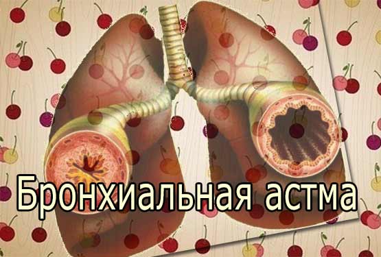 Бронхиальная астма у человека (диагноз, диагностика, течение, терапия)