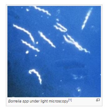 Borrelia spp. под световой микроскопией