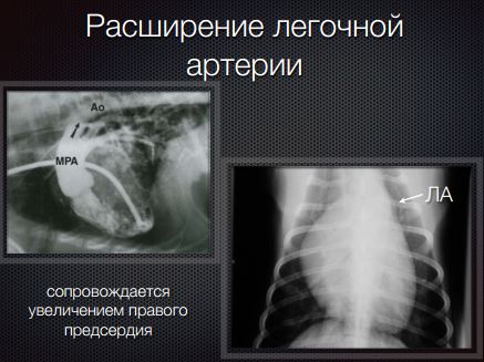 рентгенограмма собаки, выполненной в вентродорсальной прекции, при визуализации увеличения легочной артерии
