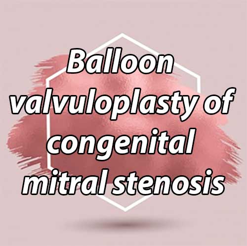 Balloon valvuloplasty of congenital mitral stenosis