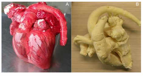 Casted heart after injection of polyurethane foam into the heart and major vessels