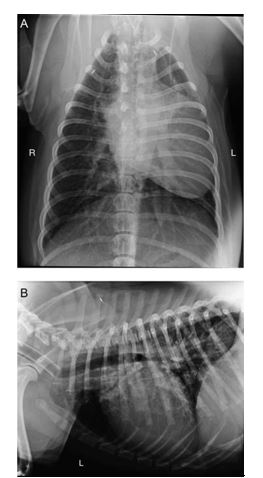 Dorsoventral (A) and left lateral (B) radiographs of the thorax taken at the referring veterinary practice
