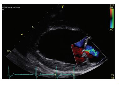 Echocardiographic image from a deerhound with preclinical dilated cardiomyopathy