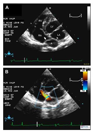 Echocardiographic images from a dog suspected to have cor triatriatum dexter