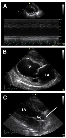Echocardiographic images from the first case of this report: a 10-year-old female, spayed Labrador Retriever