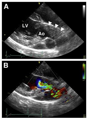 Echocardiographic images from the second case of this report: a 6.5-year-old male, castrated Labrador Retriever