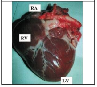 External view of the heart: cardiomegaly with eccentric hypertrophy of right ventricle (RV) and atrium