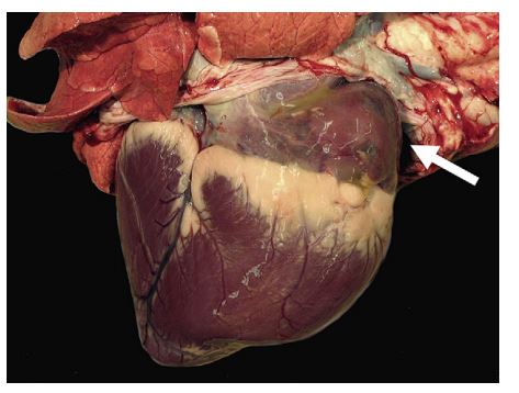 Heart, calf. There is a marked dilation of the right atrium, which is twice its normal volume