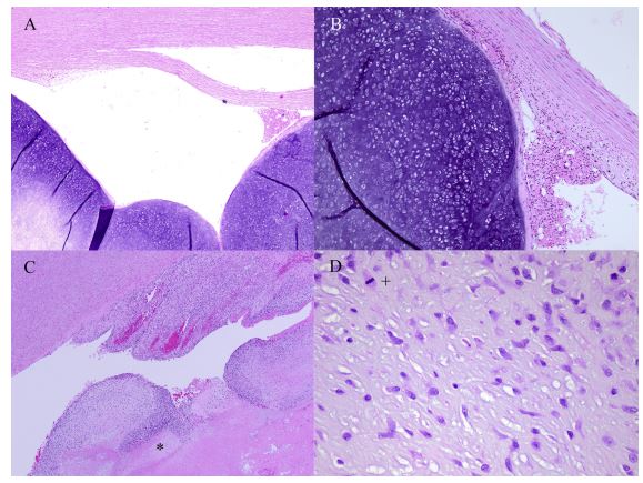 Histologic images of the aortic tumors from the Labrador Retriever dogs