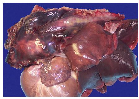 large hematoma (H) was present around the aortic root that extended caudally (H-caudal) along the length of the descending aorta