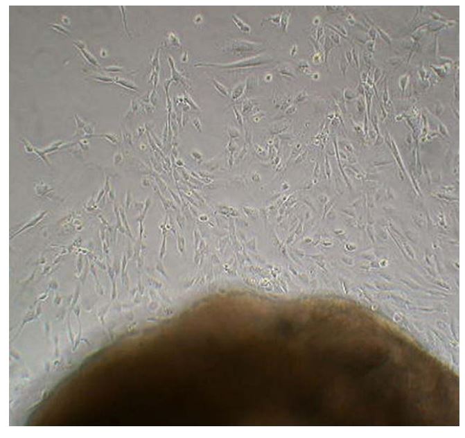 Photograph taken 4 days after tissue was placed in a 6-well culture plate showing fibroblast-like cells migrating from the valve tissue in culture