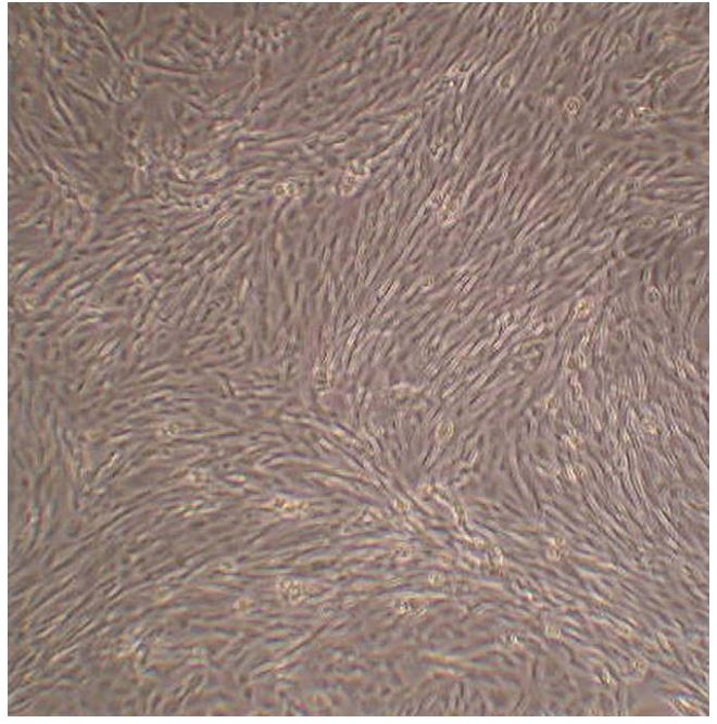Photograph taken as cells reached confluency. Note the whirling pattern that is characteristic of fibroblast-like cells