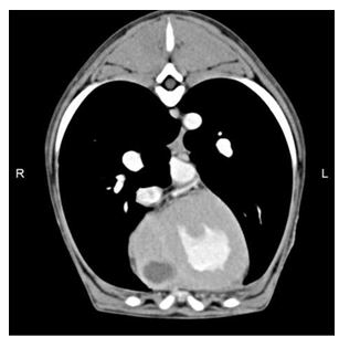 Post-contrast computed tomographic transverse plane image of the thorax with soft tissue reconstruction algorithm and mediastinal window