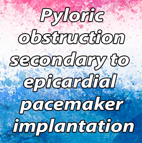 Pyloric obstruction secondary to epicardial pacemaker implantation: a case report