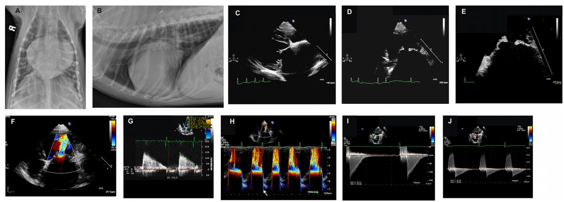 Radiographic and echocardiographic images from 2 dogs with severe congenital mitral valve stenosis that underwent cardiac catheterization and balloon valvuloplasty