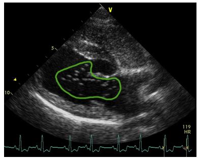 Right parasternal long-axis four-chamber view saline contrast echocardiography obtained in a dog with A. vasorum infections
