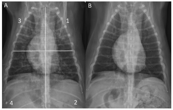 Thoracic radiograph scoring system for pulmonary infiltrates