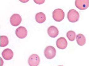 Candidatus M. Haemominutum в мазке крови инфицированной гемобартонеллезом кошки; коккообразные формы без признаков регенерации и умеренной анемией
