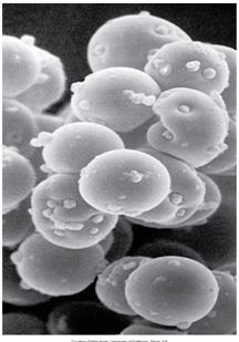 Фото электронной микроскопии эритроцитов кошки с гемобартонеллезом, инфицированной Mycoplasma haemofelis