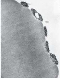 Трансмиссивная электронная микроскопия пяти микроорганизмов Mycoplasma haemofelis в прерывистом контакте с плазмалеммой эритроцита у больной гемобартонеллезом кошки